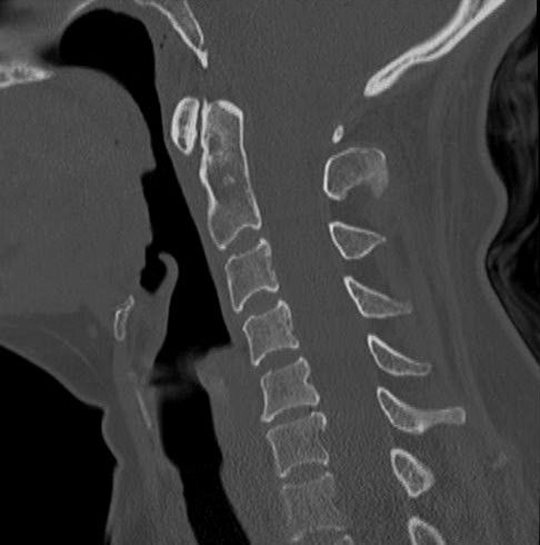Un scanner rachis et colonne vertébrale dure quelques minutes seulement dans nos centres de Brest Un scanner rachis et colonne vertébrale dure quelques minutes seulement dans nos centres de Brest